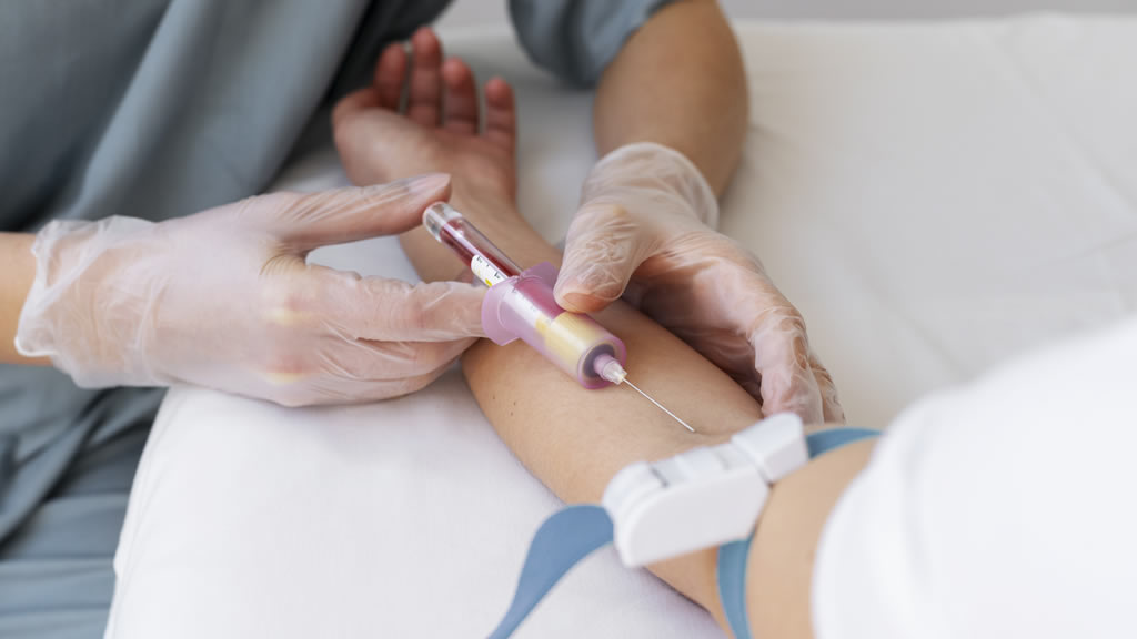 PRINCIPAIS DOENÇAS MIELOPROLIFERATIVAS